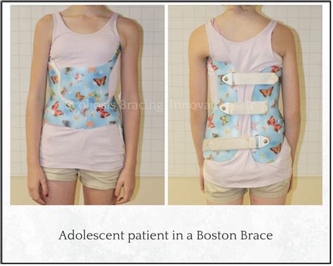 Comparing Scoliosis Braces Scoliosis Bracing Innovations