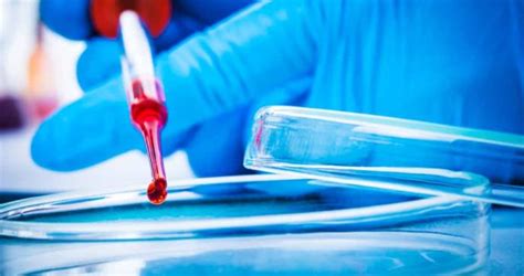 biopsia líquida el análisis de sangre experimental que permitió detectar el cáncer sin síntomas