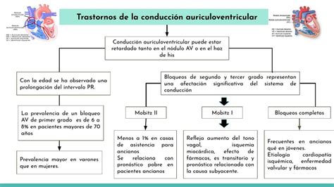 Trastornos de la Conducción Auriculoventricular en el Anciano MiddleMedic uDocz