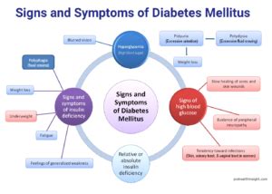 The disease is present for life. Signs and Symptoms of Diabetes Mellitus Analyzed