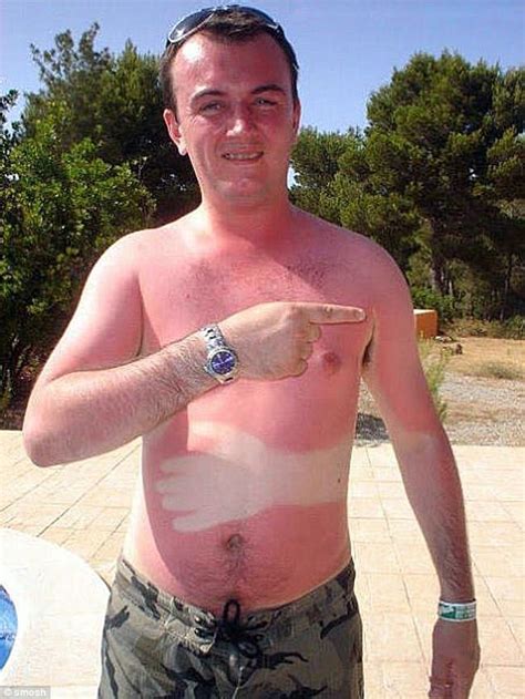 Are These The Worst Sun Tan Fails Ever Daily Mail Online