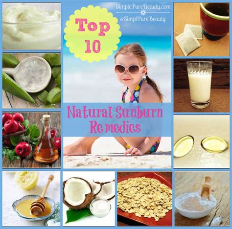 Top 10 Natural Home Remedies For Sunburn Itch And Pain Delicious