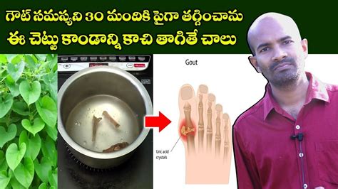 Gout Ayurvedic Herbal Remedies In Telugu By Dr Chandra Mouli Tippa