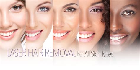 Types Of Laser Hair Removal
