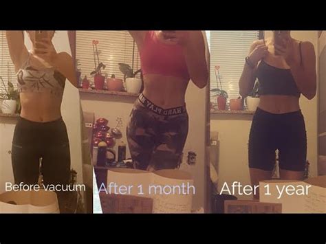 Doing Stomach Vacuum For One Year Was The Difference Any Obvious