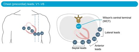 The Ecg Leads Electrodes Limb Leads Chest Precordial Leads And The