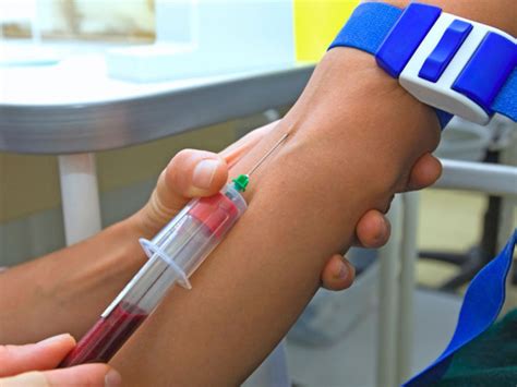 Cómo extraer sangre de una vena en un niño y por qué se necesita en