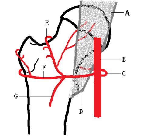 Arteries Around The Proximal Femur A Iliopsoas Muscle B Profunda