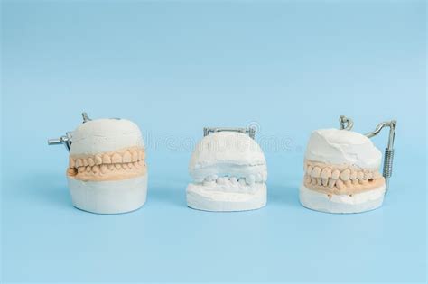 Model Of Teeth And Gums On Blue Background Dental Concept Stock Image