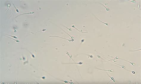 human sperm under microscope