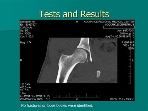 Ppt Shortened And Internally Rotated Right Leg Powerpoint