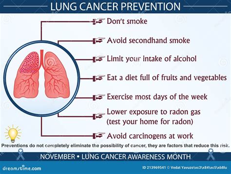 Lung Cancer Prevention Infographic Vector Illustration Stock Vector