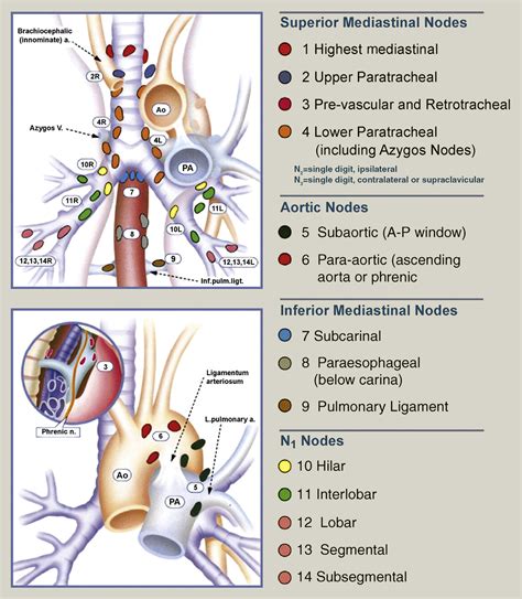 Principles Of Posterolateral Thoracotomy And Pneumonectomy Surgery