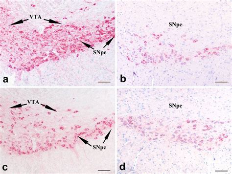 Immunohistochemical Staining Of Th Immunoreactive Neurons In The Snpc Download Scientific