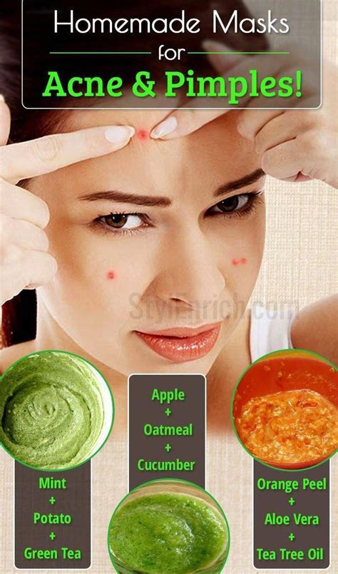 Skin Care Advice That Can Really Help You Home Remedies For Pimples