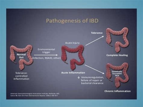 Inflammatory Bowel Disease In Pediatrics
