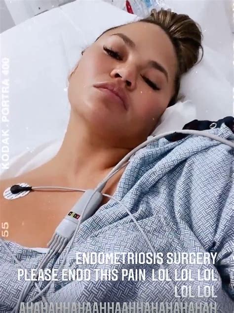 Chrissy Teigen Shares Selfie Showing Her Scars From Surgery