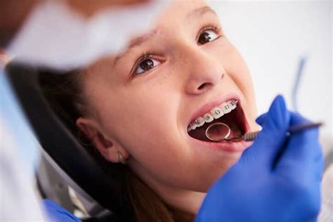 Everything You Needed To Know About Accelerated Orthodontics King
