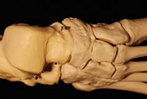 Foot Bones Allow Researchers To Determine Sex Of Skeletal Remains Department Of Sociology And