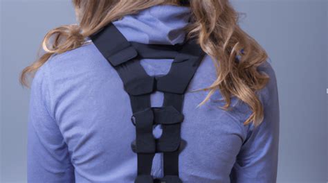 Wilmington Brace For Scoliosis Everything You Need To Know Align Clinic
