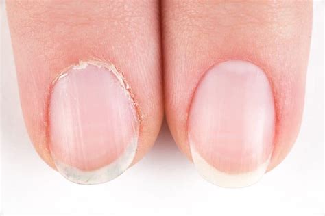 What Are Cuticles Cuticle Care 101