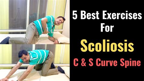 5 Best Exercises For Scoliosis How To Correct Scoliosis Stretches For Scoliosis Spinal