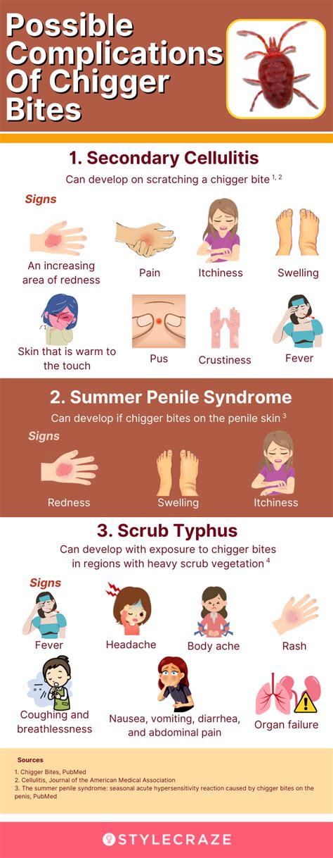 Home Remedies For Chigger Bites And Prevention Tips