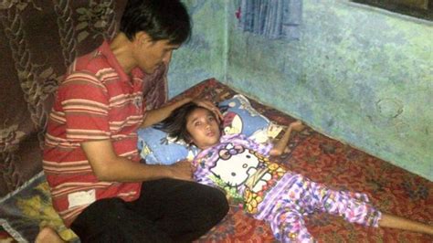 Gadis Kecil Penderita Penyakit Langka Ataxia Kini Hanya