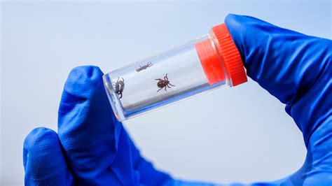A New Lyme Disease Test In Development May Help Improve Treatment