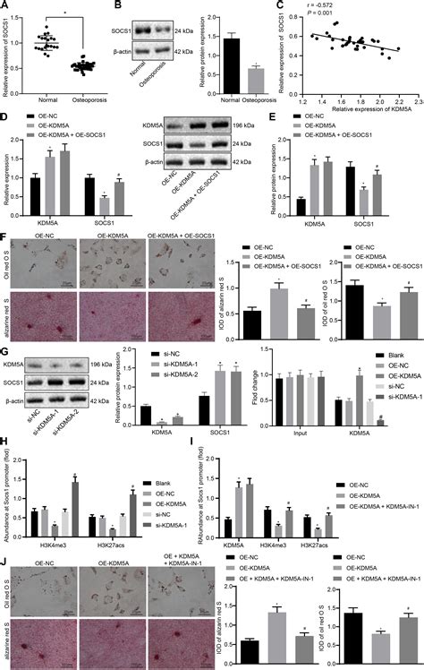 frontiers extracellular vesicle encapsulated mir 29b 3p released from bone marrow derived