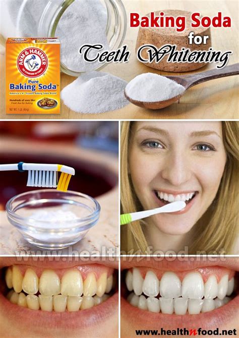 4 Natural Remedies For Teeth Whitening At Home