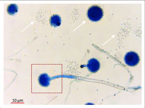 Aspergillus Microscopic View