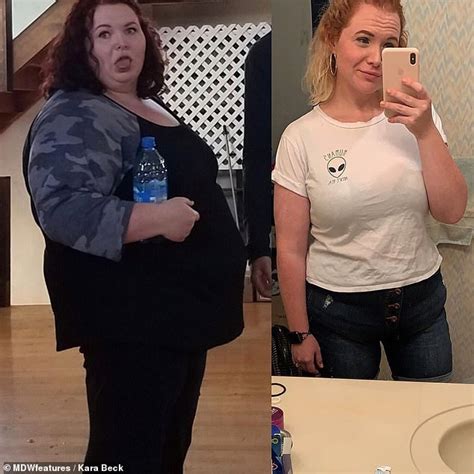 Woman Who Weighed 370 Pounds Loses 196lbs But Says Leftover Loose