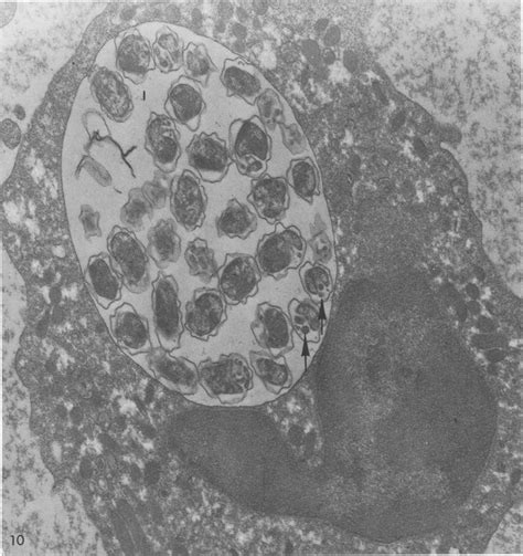 Neutrophil With An Inclusion I Containing Numerous Organisms Dense