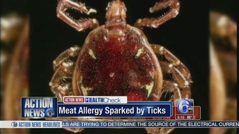Video Meat Allergy Sparked By Tick 6abc Philadelphia