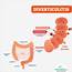 Diverticulitis – Causes Symptoms And Treatment  Netmeds