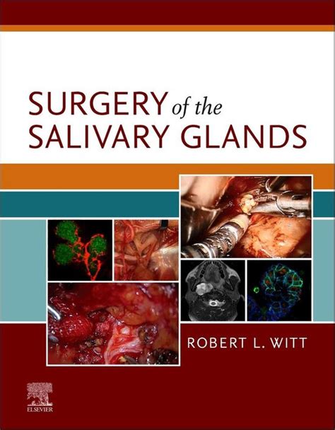 Surgery Of The Salivary Glands Ebook Robert L Witt Md