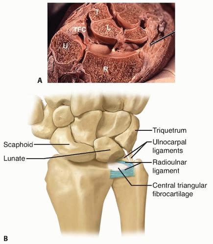 Ezek a bal oldalon vannak felsorolva. Arthroscopic and Open Triangular Fibrocartilage Complex ...
