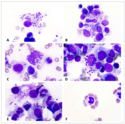 Images From The Haematologica Atlas Of Hematologic Cytology Visceral