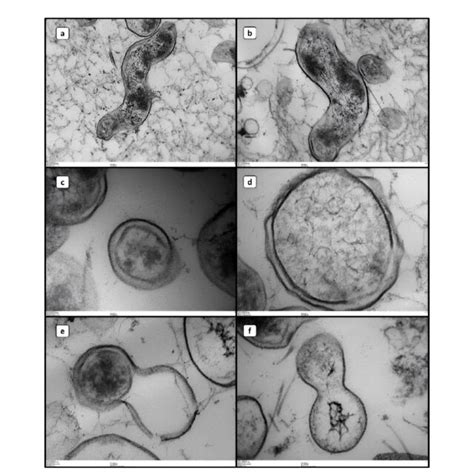 Scanning Electron Microscopy Images Of Campylobacter Jejuni In