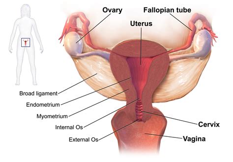 Ovarian Cancer Geeky Medics