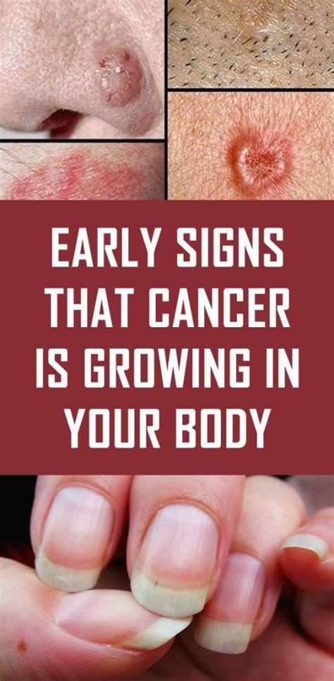 Early Signs That Cancer Is Growing In Your Body Healthy And News