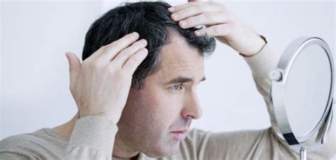 Enfermedades que podrían causar caída del cabello