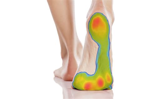 3d Foot Scan And 3d Pressure Mapping Studio Podiatry Podiatrist