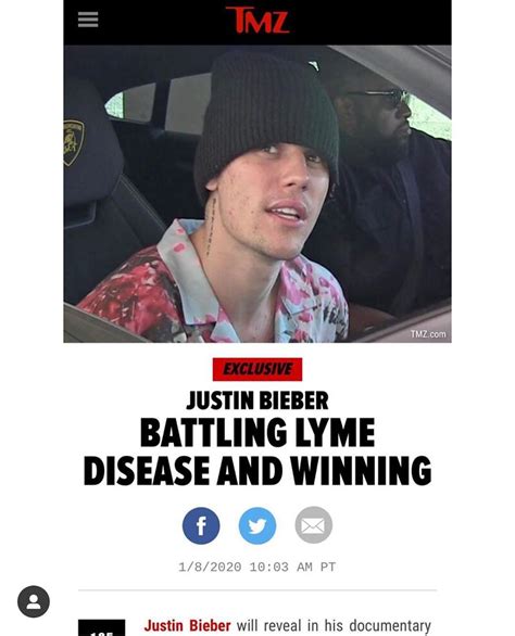 Justin Bieber Mengidap Lyme Disease Ini Faktanya Orami