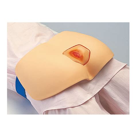 Decubitus Ulcer Treatment Simulator M Sakamoto Model Corporation Buttock