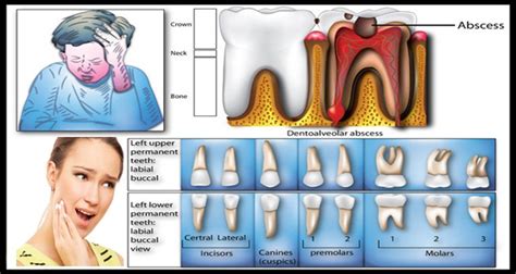 What Is A Toothache Dr Ari Greenspan Dentist
