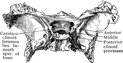 Abnormal Sphenoid Bone Clipart Etc
