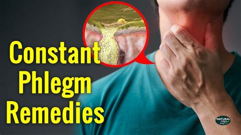 How To Get Rid Of Constant Mucus And Phlegm In Throat Natural Cures