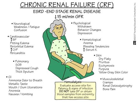 Chronic Renal Failure Dialysis Nurse Nursing Mnemonics Nursing